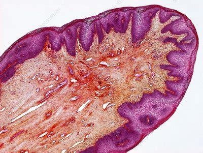 hymen foto|Hymen Bilder Science Photo Library